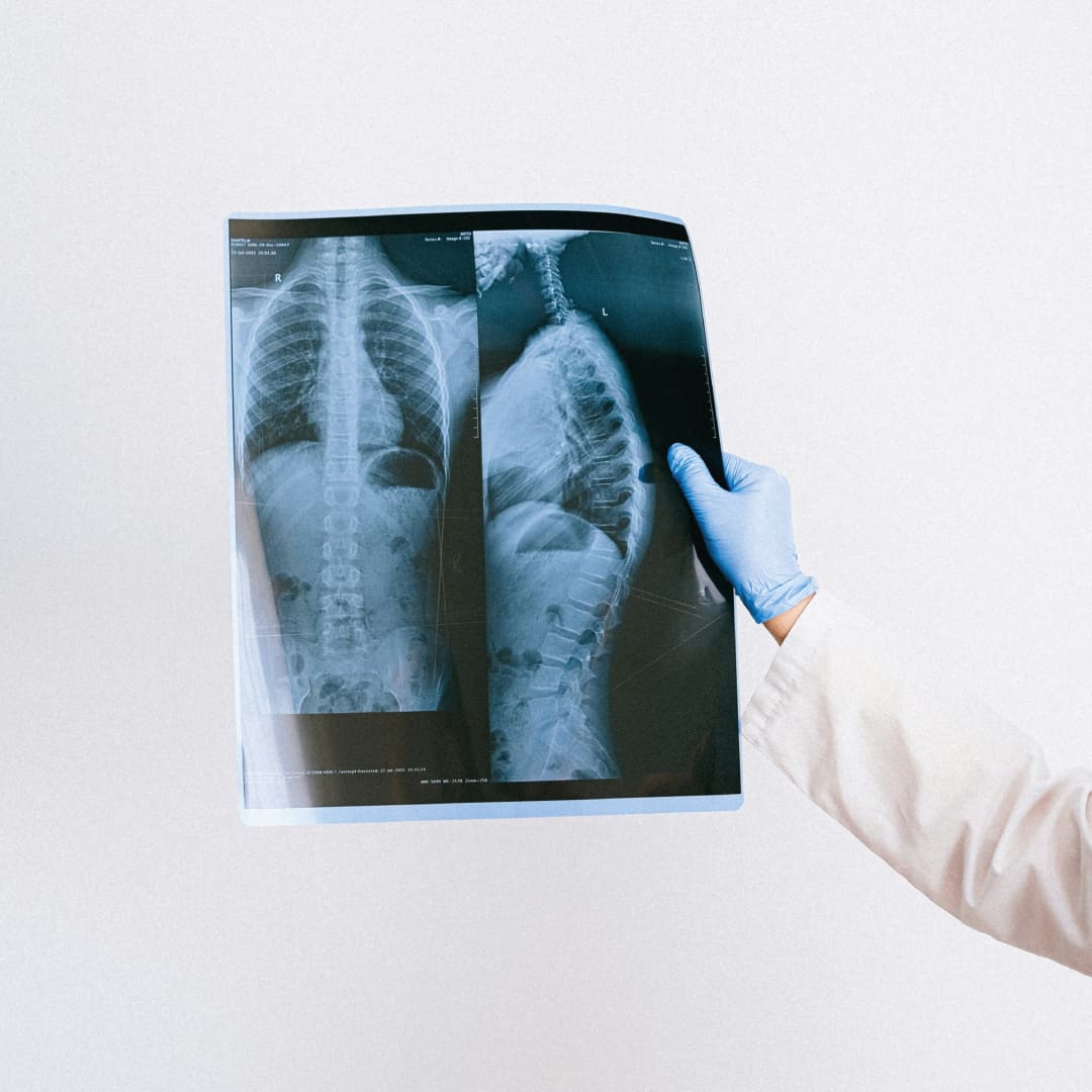 Curso de Xadrez