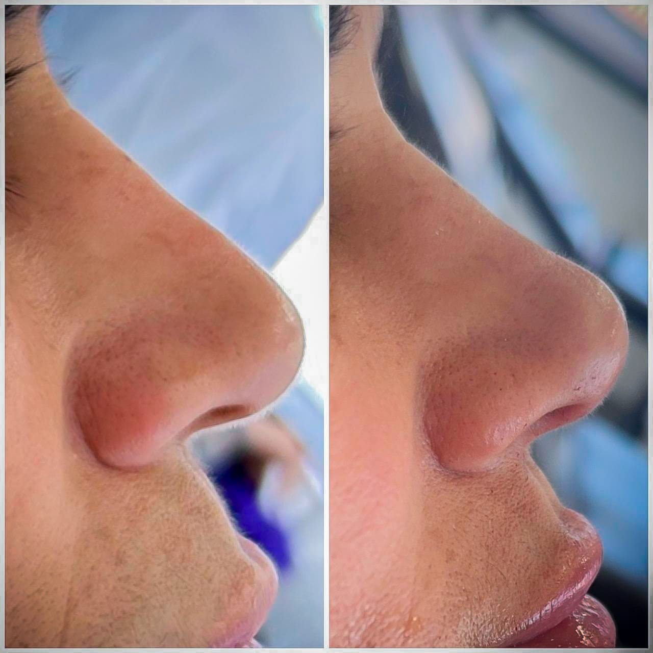 Curso de Estética - Técnicas modernas