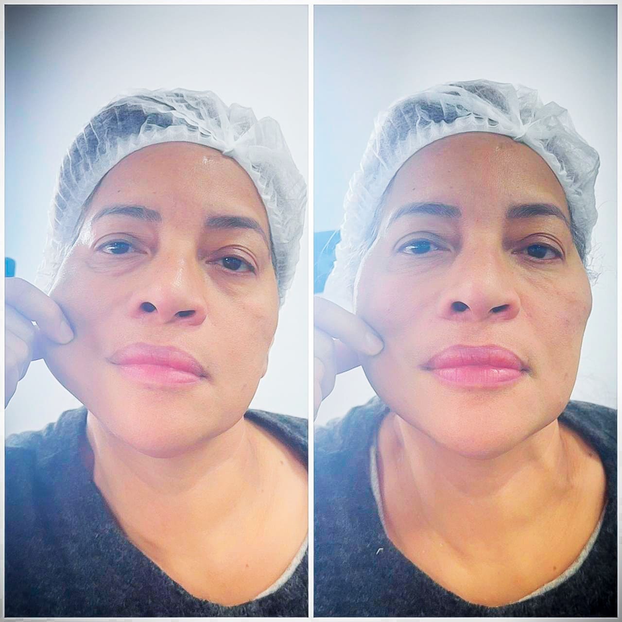 Curso de Estética - Tratamentos de pele