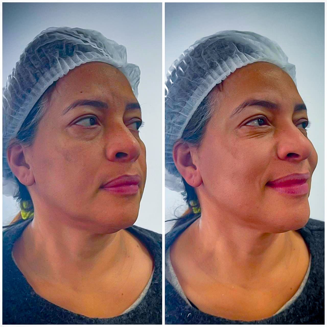 Curso de Estética - Atividade laboratorial prática