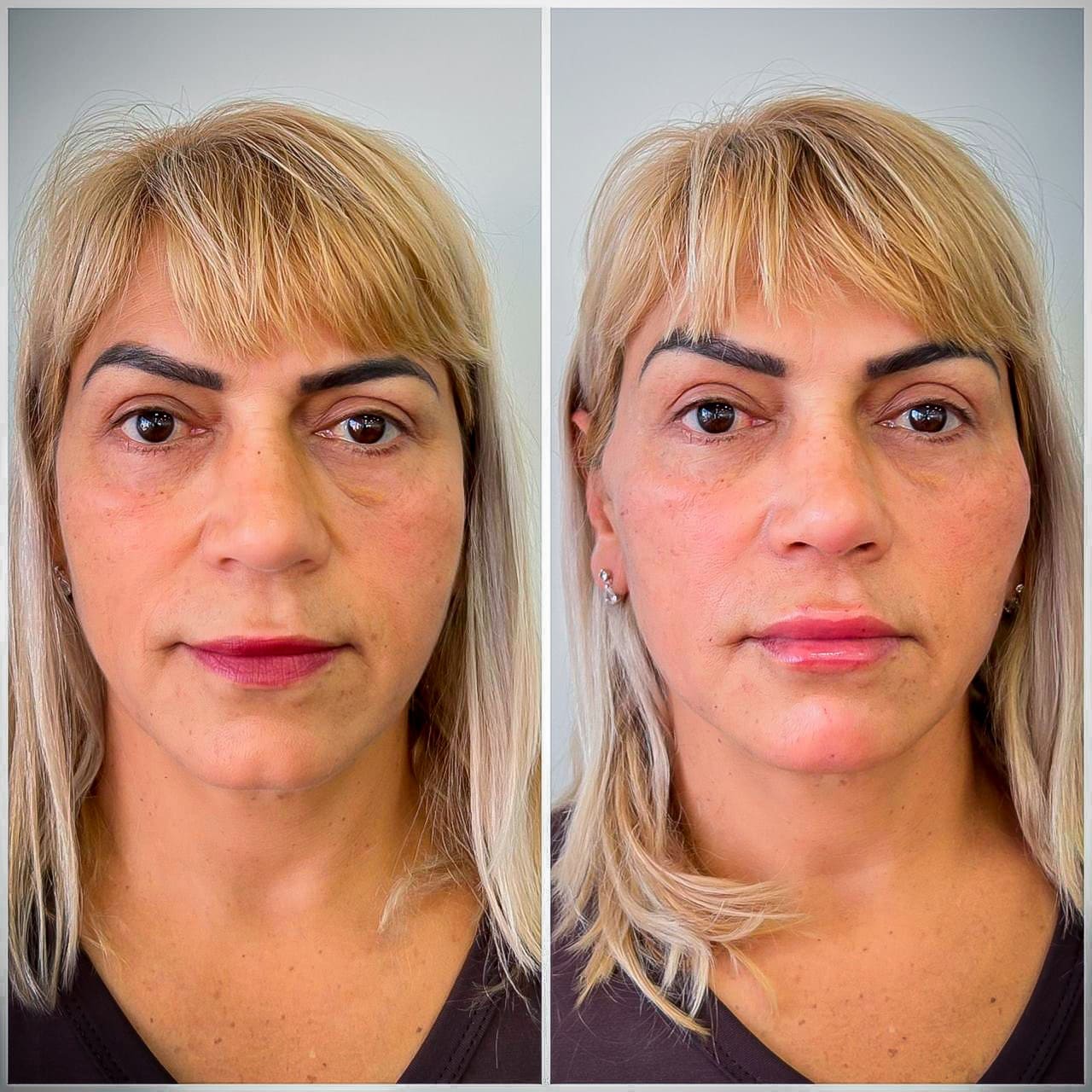 Curso de Estética - Estética facial e corporal