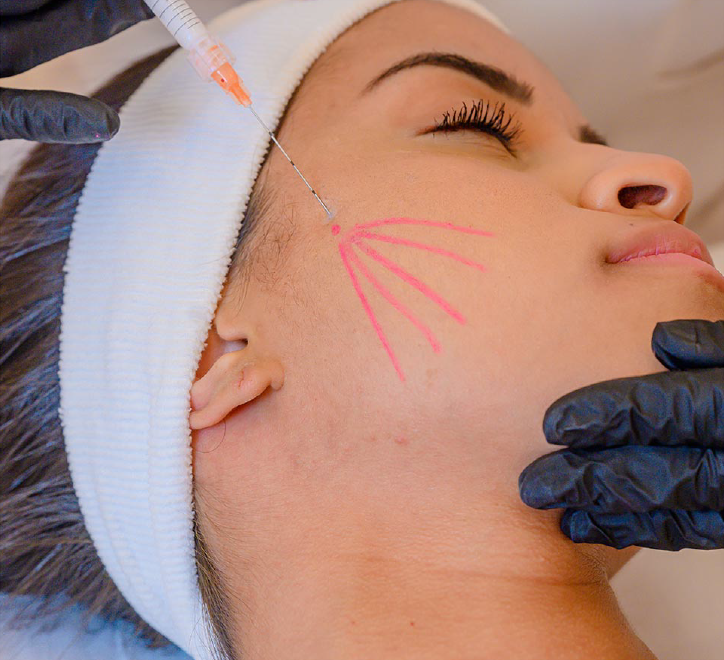 Curso de Capacitação - Toxina e Preenchedor