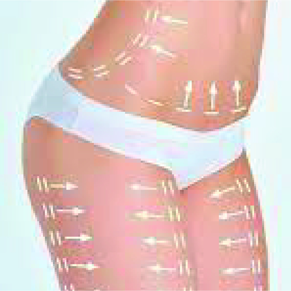 Inovações tecnológicas para tratamentos corporais e wellness