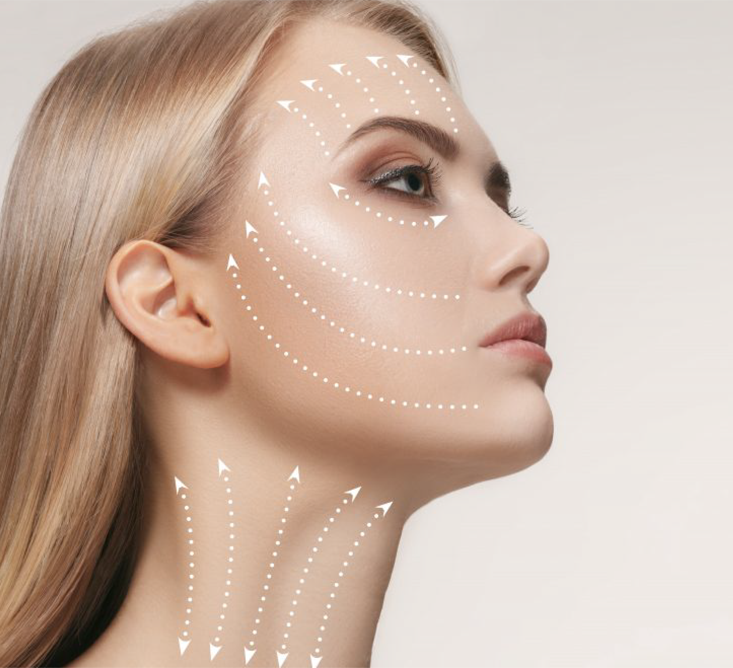 Curso de Capacitação - Fios de Sustentação