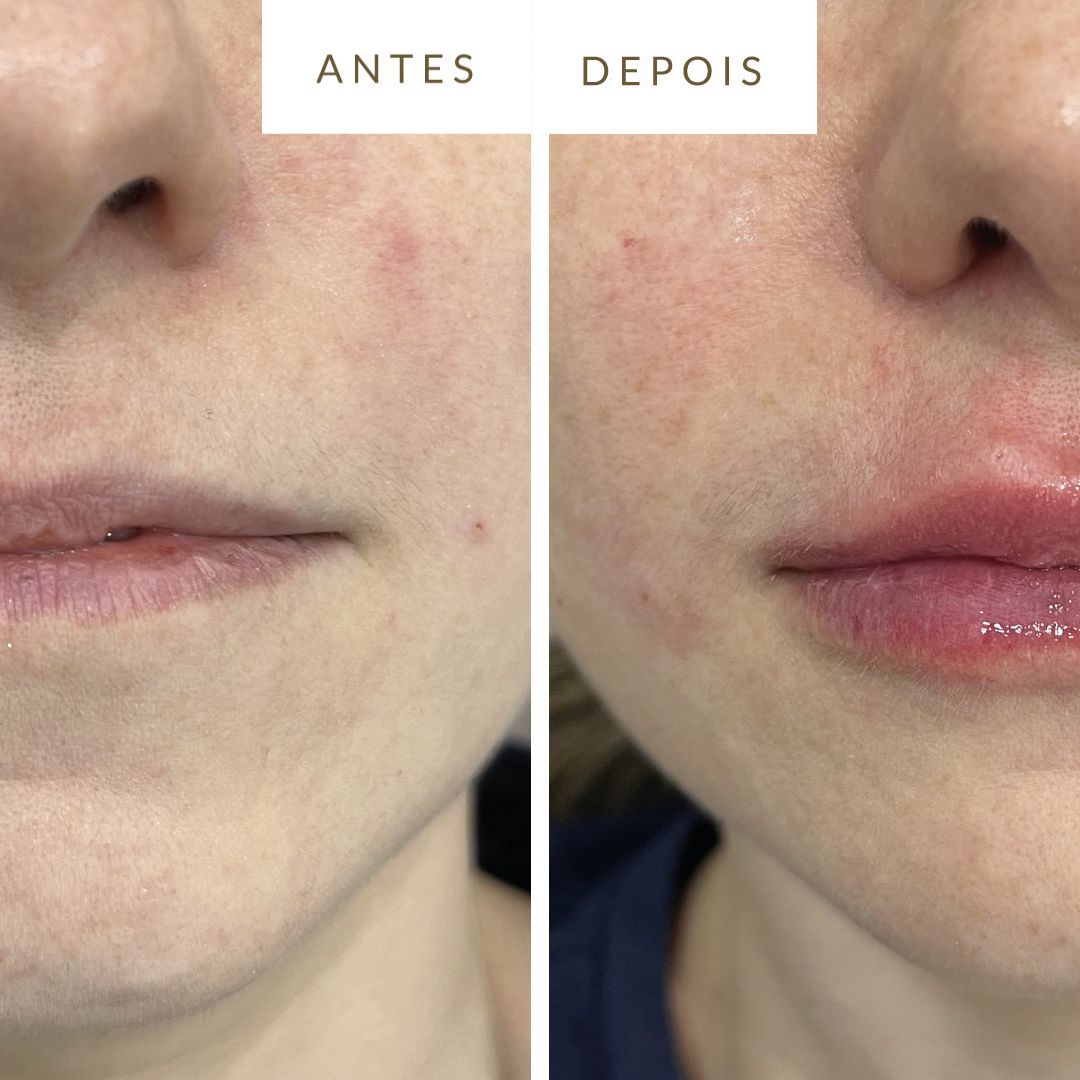 Curso de Novas Tecnologias em Estética com prática em equipamentos avançados