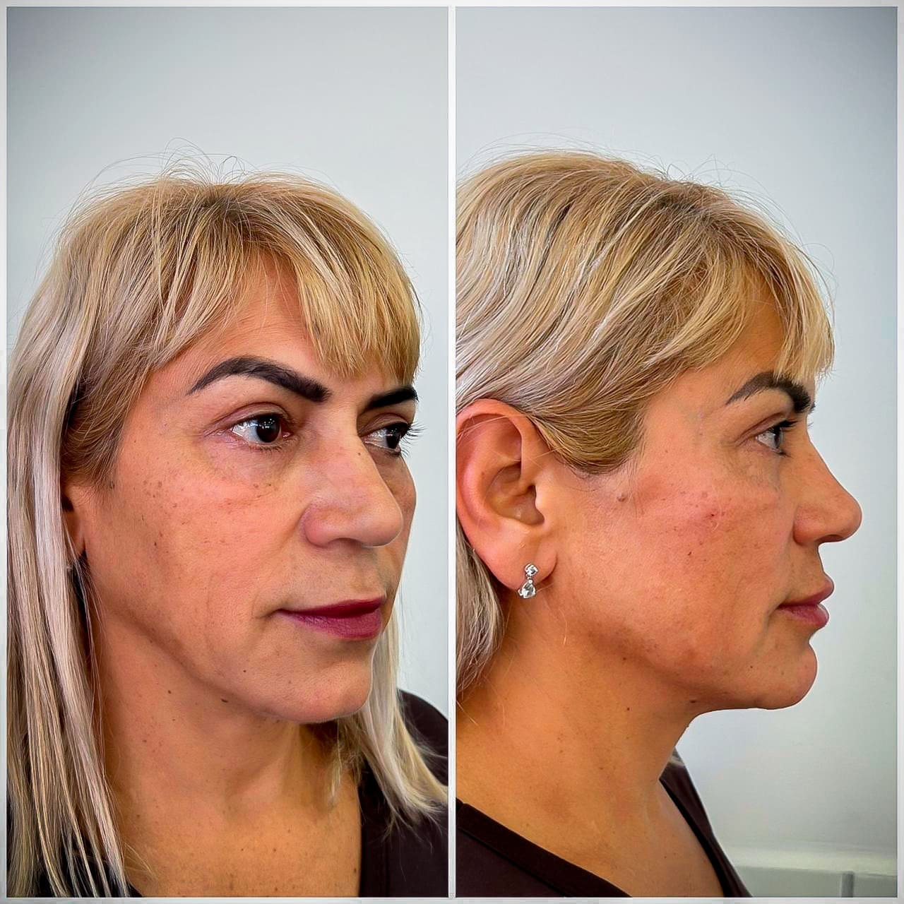Curso de Estética - Estética facial e corporal