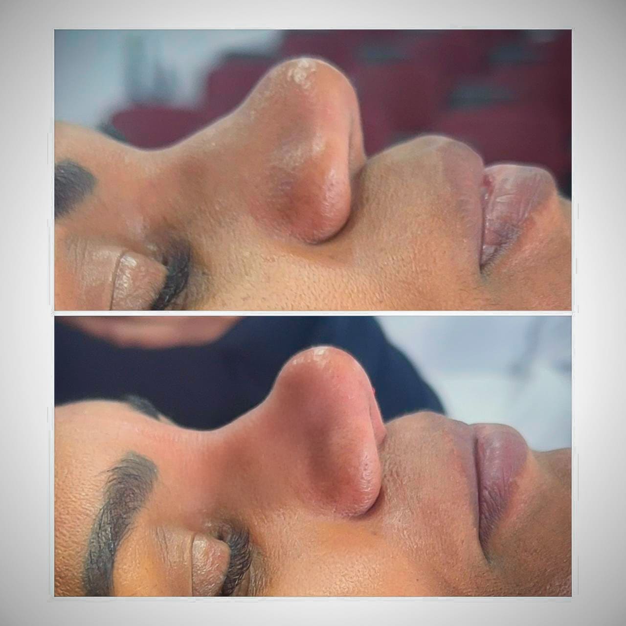 Curso de Estética - Tratamento estético supervisionado