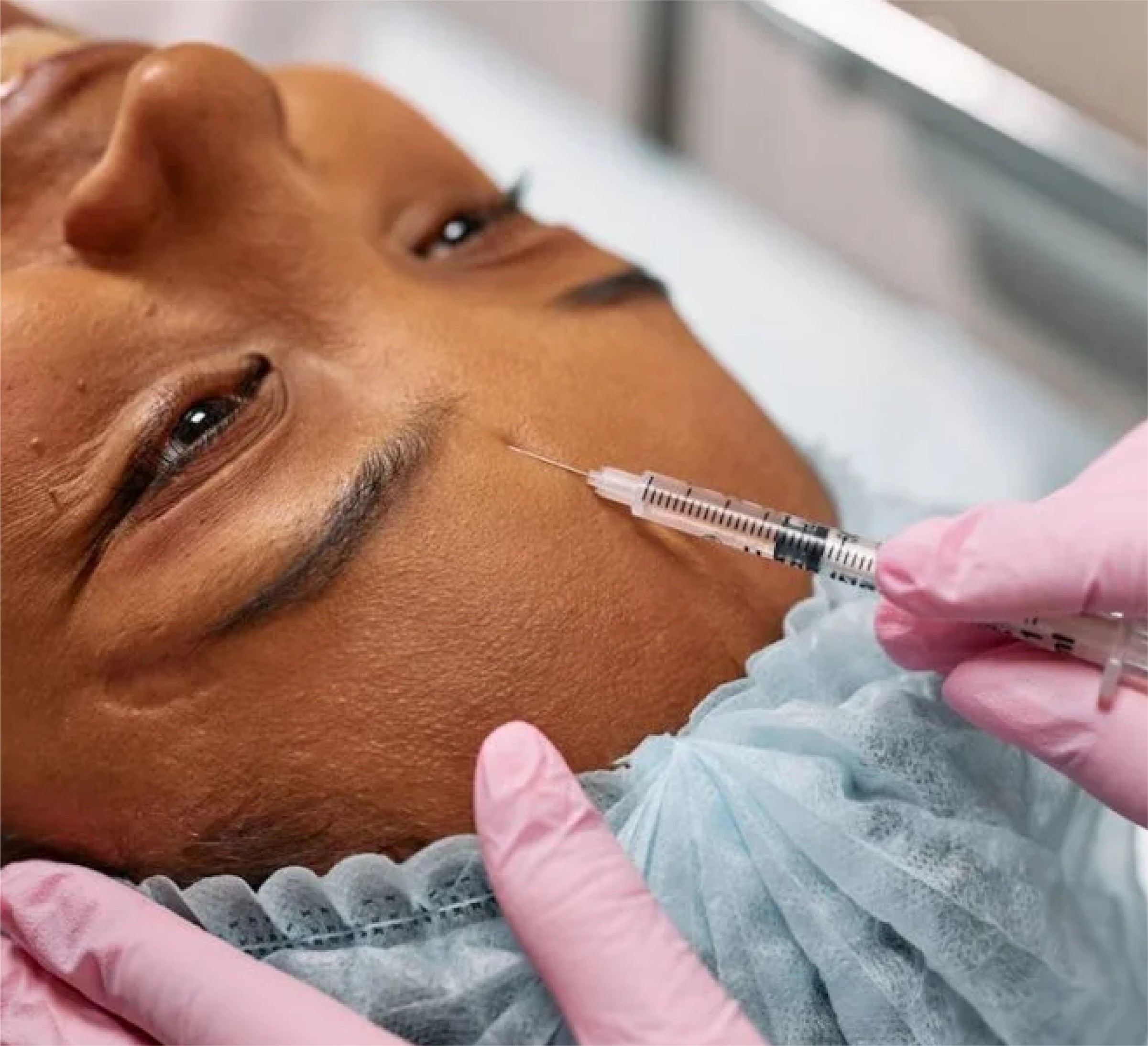 Curso de Capacitação - Bioestimulador de Colágeno