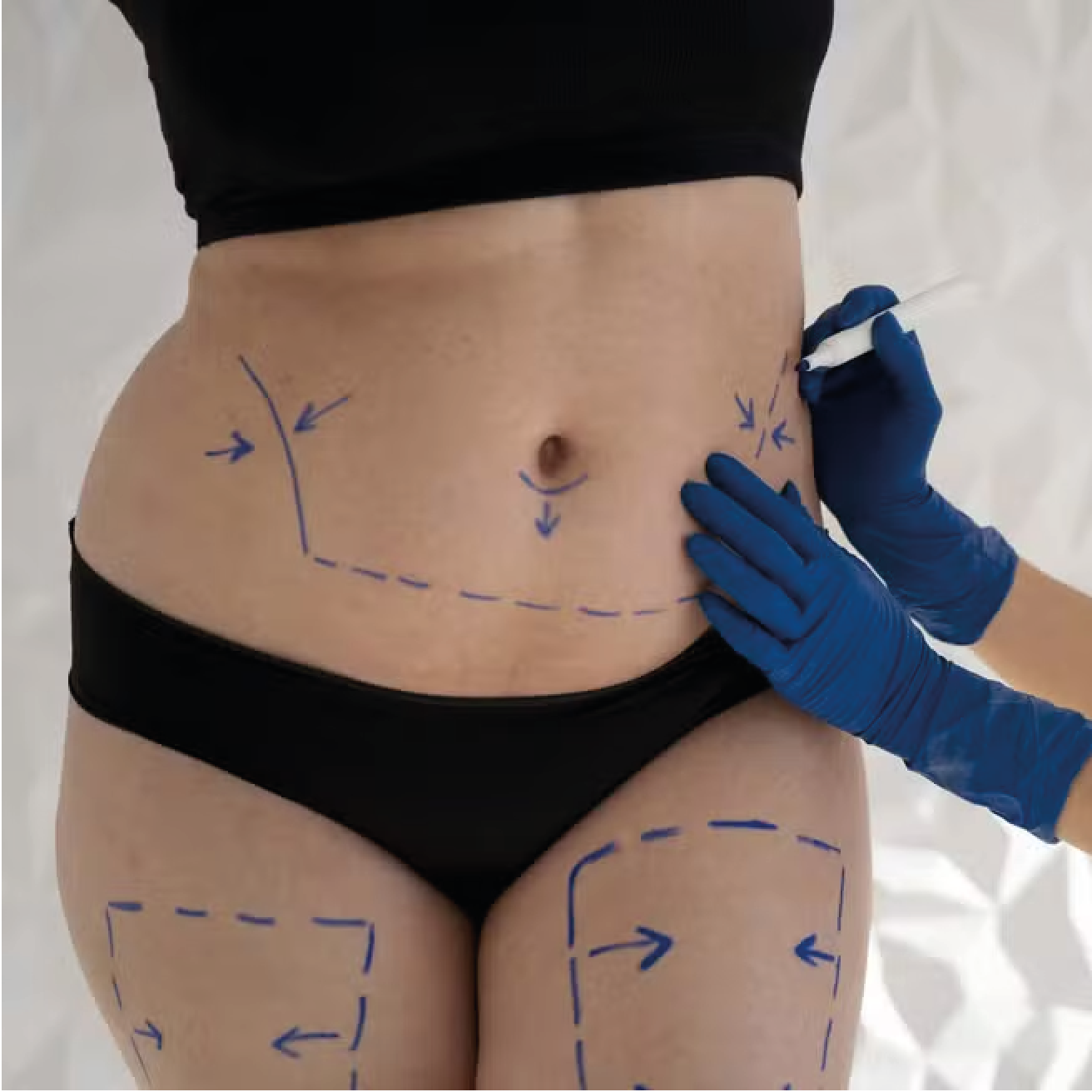 Consultoria em nutrição funcional e estética