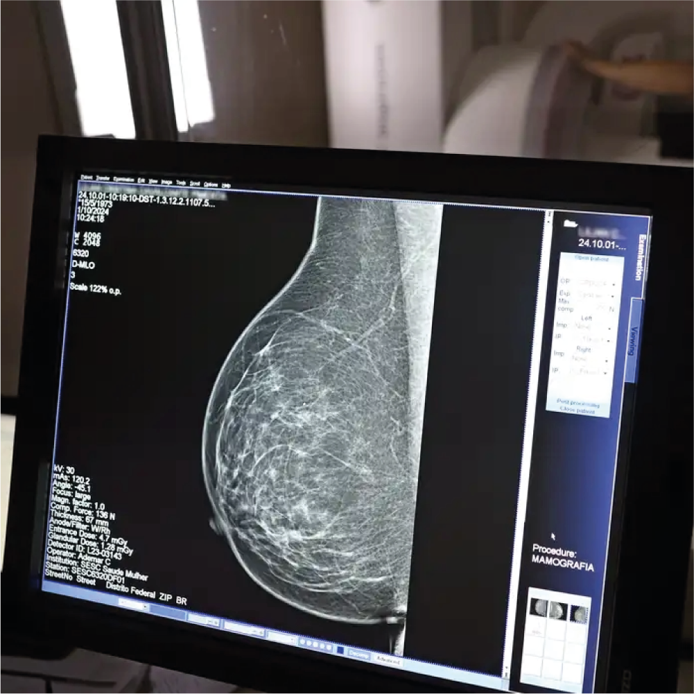 Imagem Mamária e Diagnóstico Avançado